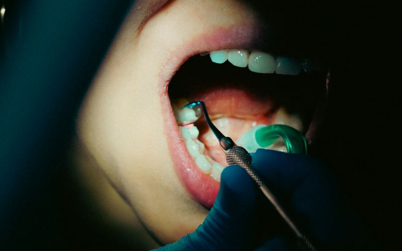 How Long Does a Root Canal Take?
