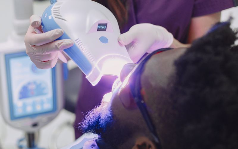 Teeth Whitening in Pembroke Pines: Professional vs. At-Home